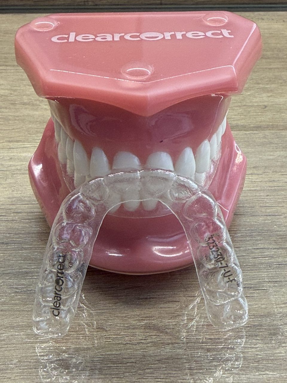Modelo de alinhador ClearCorrect na Clínica Karina Marani